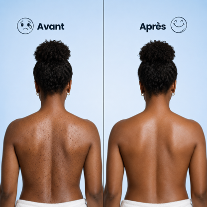 Serviette exfoliante Sorea